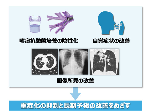 肺MAC症の治療の意義・目的